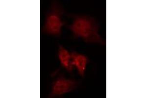 ABIN6266971 staining Hela by IF/ICC. (GPRASP1 anticorps  (Internal Region))
