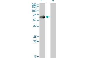Western Blot analysis of CDC25C expression in transfected 293T cell line by CDC25C monoclonal antibody (M01A), clone 3B11. (CDC25C anticorps  (AA 21-130))