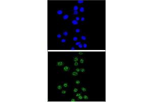 Confocal immunofluorescent analysis of NBN Antibody (C-term) (ABIN655721 and ABIN2845169) with Hela cell followed by Alexa Fluor® 488-conjugated goat anti-rabbit lgG (green).