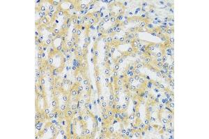 Immunohistochemistry of paraffin-embedded mouse kidney using CaMKI antibody (ABIN7266017) at dilution of 1:100 (40x lens).
