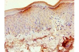 Immunohistochemistry of paraffin-embedded human skin tissue using ABIN7170845 at dilution of 1:100