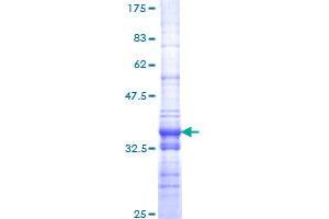 Image no. 1 for SWI/SNF Related, Matrix Associated, Actin Dependent Regulator of Chromatin, Subfamily A, Member 2 (SMARCA2) (AA 659-735) protein (GST tag) (ABIN1320621)