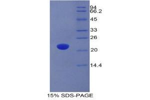 SDS-PAGE (SDS) image for Adrenomedullin (ADM) (AA 27-184) protein (His tag) (ABIN1878284)