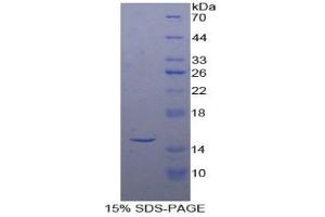 SDS-PAGE of Protein Standard from the Kit (Highly purified E.