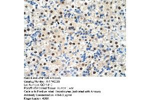 Human Liver (ZNF326 anticorps  (C-Term))
