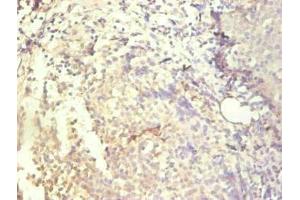 Immunohistochemical of paraffin-embedded human tonsil tissue using ABIN7156932 at dilution of 1:200. (IL-8 anticorps)