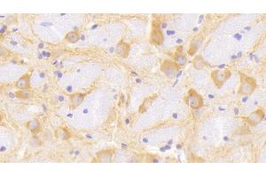 Detection of MAP2 in Rat Cerebrum Tissue using Polyclonal Antibody to Microtubule Associated Protein 2 (MAP2)