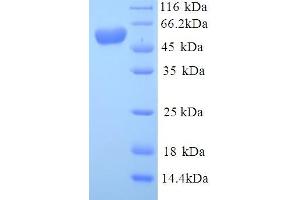 SDS-PAGE (SDS) image for Mdm2, p53 E3 Ubiquitin Protein Ligase Homolog (Mouse) (MDM2) (AA 1-489), (full length) protein (His tag) (ABIN5713638)