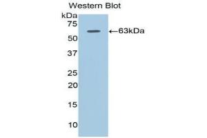 Western blot analysis of the recombinant protein. (Adiponectin Receptor 1 anticorps  (AA 1-136))
