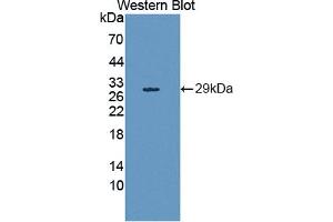 Western blot analysis of the recombinant protein. (HAND1 anticorps  (AA 1-215))