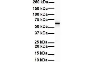 WB Suggested Anti-SNRP70 antibody Titration: 1 ug/mL Sample Type: Human Raji (SNRNP70 anticorps  (C-Term))