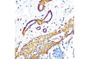 Immunohistochemistry of paraffin-embedded human colon using Filamin A Rabbit mAb (ABIN1682545, ABIN3018024, ABIN3018025 and ABIN7101570) at dilution of 1:100 (40x lens). (Filamin A anticorps)