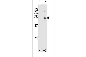 Western blot analysis of HPRT1 (arrow) using rabbit polyclonal HPRT1 Antibody (C-term) (ABIN390692 and ABIN2840982). (HPRT1 anticorps  (C-Term))