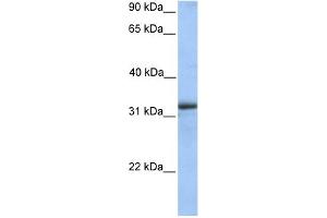 WB Suggested Anti-ETFA Antibody Titration: 0. (ETFA anticorps  (Middle Region))
