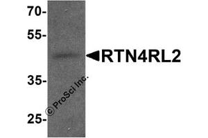 Western Blotting (WB) image for anti-Reticulon 4 Receptor-Like 2 (RTN4RL2) (C-Term) antibody (ABIN1077412) (RTN4RL2 anticorps  (C-Term))