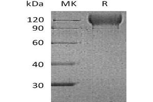 Western Blotting (WB) image for Selectin P (Granule Membrane Protein 140kDa, Antigen CD62) (SELP) protein (His tag,AVI tag) (ABIN7320863)
