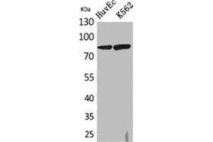 Western Blot analysis of HuvEc, K562 cells using 17β-HSD4 Polyclonal Antibody. (HSD17B4 anticorps  (N-Term))
