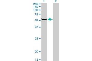 Western Blotting (WB) image for anti-Target of EGR1, Member 1 (Nuclear) (TOE1) (AA 1-511) antibody (ABIN599318) (TOE1 anticorps  (AA 1-511))