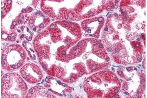 Human Kidney: Formalin-Fixed, Paraffin-Embedded (FFPE)