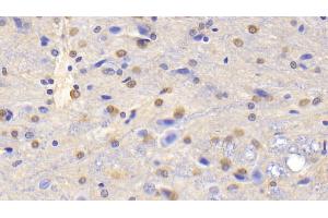 Detection of GS in Rat Cerebrum Tissue using Polyclonal Antibody to Glutamine synthetase (GS)