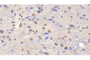 Detection of GS in Rat Cerebrum Tissue using Polyclonal Antibody to Glutamine synthetase (GS) (GLN1 anticorps  (AA 1-373))