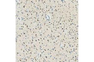 IHC analysis of SMARCA2/BRM using anti-SMARCA2/BRM antibody (ABIN7601969).