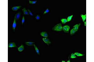 Immunofluorescent analysis of Hela cells using ABIN7151222 at dilution of 1:100 and Alexa Fluor 488-congugated AffiniPure Goat Anti-Rabbit IgG(H+L)