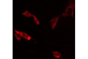 ABIN6274836 staining RAW264. (SCNN1D anticorps  (C-Term))