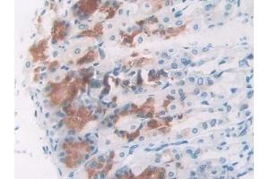 Detection of NPM1 in Mouse Stomach Tissue using Polyclonal Antibody to Nucleophosmin 1 (NPM1)