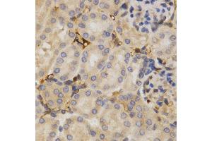 Immunohistochemistry of paraffin-embedded mouse kidney using ELAVL1 antibody at dilution of 1:200 (x400 lens).