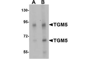 Western blot analysis of TGM5 in rat heart tissue lysate with TGM5 Antibody  at (A) 1 and (B) 2 ug/mL. (Transglutaminase 5 anticorps  (C-Term))
