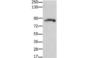 Western Blot analysis of Mouse brain tissue using KCNH2 Polyclonal Antibody at dilution of 1:100