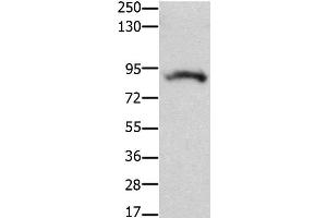 Western Blot analysis of Mouse brain tissue using KCNH2 Polyclonal Antibody at dilution of 1:100 (KCNH2 anticorps)