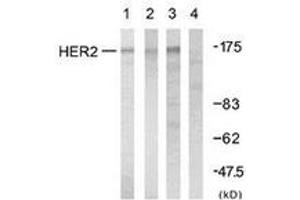 Western blot analysis of extracts from A2780 cells, using HER2 (Ab-1248) Antibody. (ErbB2/Her2 anticorps  (AA 1206-1255))