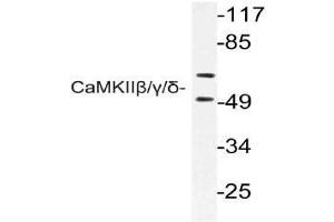 Western blot (WB) analysis of CaMKIIbeta/gamma/delta antibody in extracts from rat brain cells. (CAMK2B anticorps)