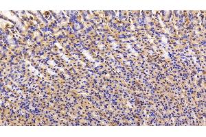 Detection of CAV1 in Rat Stomach Tissue using Polyclonal Antibody to Caveolin 1 (CAV1)