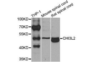 Western blot analysis of extracts of various cells, using CHI3L2 antibody. (CHI3L2 anticorps)