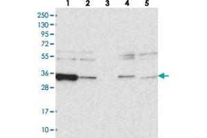 Western blot analysis of Lane 1: RT-4, Lane 2: U-251 MG, Lane 3: Human Plasma, Lane 4: Liver, Lane 5: Tonsil with ACTR6 polyclonal antibody . (ACTR6 anticorps)