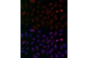 Immunofluorescence analysis of A-549 cells using MCU Rabbit pAb (ABIN7268549) at dilution of 1:200 (40x lens).