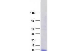 Validation with Western Blot