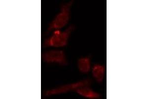 ABIN6274038 staining HepG2 by IF/ICC. (Melanoma gp100 anticorps  (C-Term))