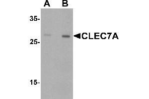 Western blot analysis of CLEC7A in rat spleen tissue lysate with CLEC7A antibody at (A) 1 and (B) 2 ugg/. (CLEC7A anticorps  (Middle Region))