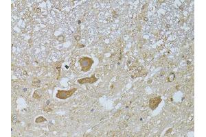 Immunohistochemistry of paraffin-embedded rat spinal cord using HDAC8 antibody (ABIN5973443) at dilution of 1/100 (40x lens). (HDAC8 anticorps)