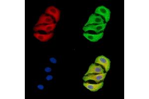 ABIN7096403 and ABIN7100467 staining Hela cells by IF/ICC. (TIMMDC1 anticorps)
