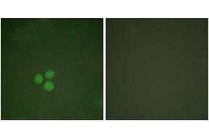 Immunofluorescence analysis of HeLa cells, using DP-1 Antibody. (TGM4 anticorps  (AA 361-410))