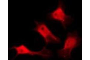 ABIN6274935 staining HeLa by IF/ICC. (CHP anticorps  (Internal Region))