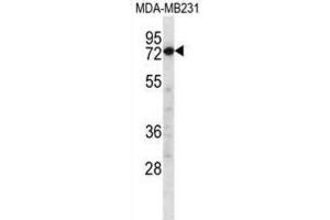 Western Blotting (WB) image for anti-Calpain 8 (CAPN8) antibody (ABIN2997182) (Calpain 8 anticorps)