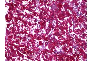 Anti-MDH1 antibody IHC of human adrenal.