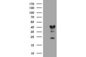 Image no. 1 for anti-Transmembrane Protein 173 (TMEM173) antibody (ABIN1501430) (STING/TMEM173 anticorps)