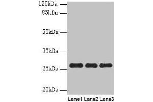 Western blot All lanes: PEX11B antibody at 10 μg/mL Lane 1: 293T whole cell lysate Lane 2: Hela whole cell lysate Lane 3: K562 whole cell lysate Secondary Goat polyclonal to rabbit IgG at 1/10000 dilution Predicted band size: 29, 27 kDa Observed band size: 27 kDa (PEX11B anticorps  (AA 9-228))